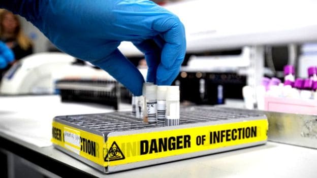 கொரோனா வைரஸ்: எந்தெந்த பரப்புகளில் எவ்வளவு நேரம் உயிர் வாழும்? 2